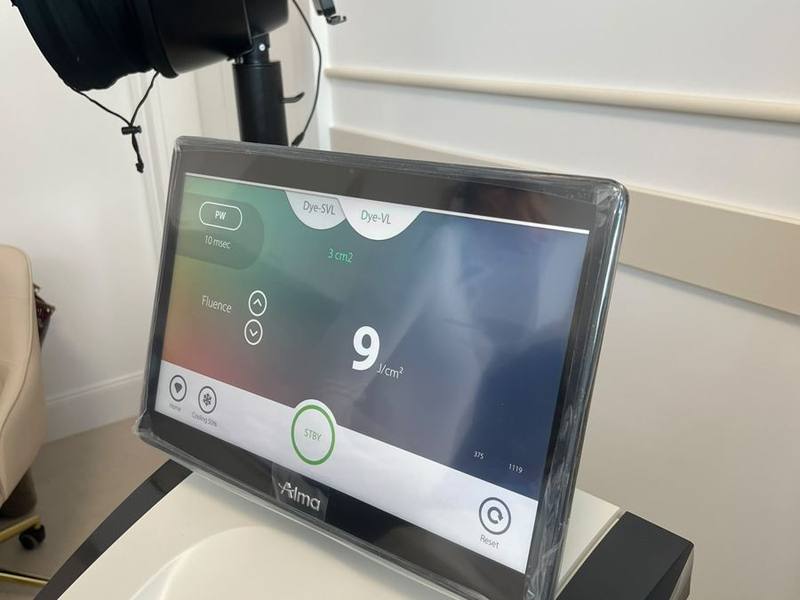 Alma Harmony XL Pro: ekran z parametrami głowicy Dye-VL